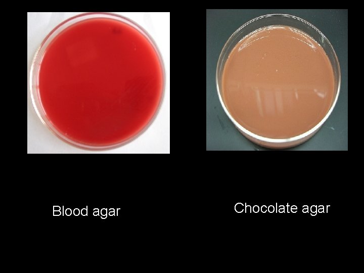Blood agar Chocolate agar 