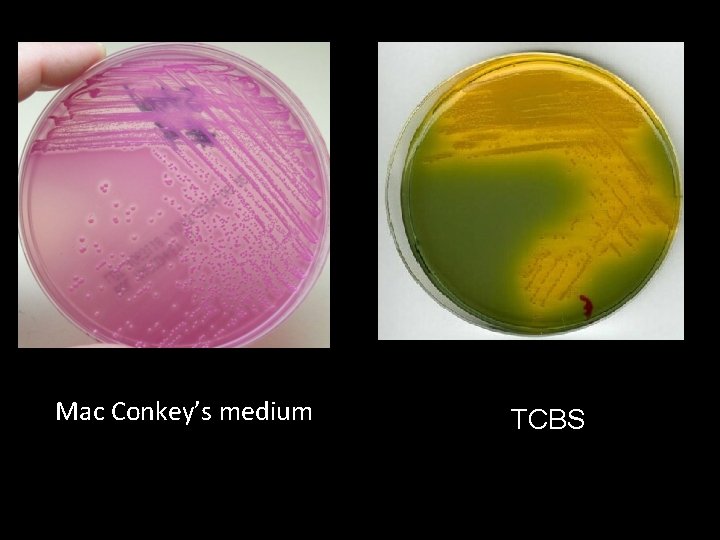 Mac Conkey’s medium TCBS 