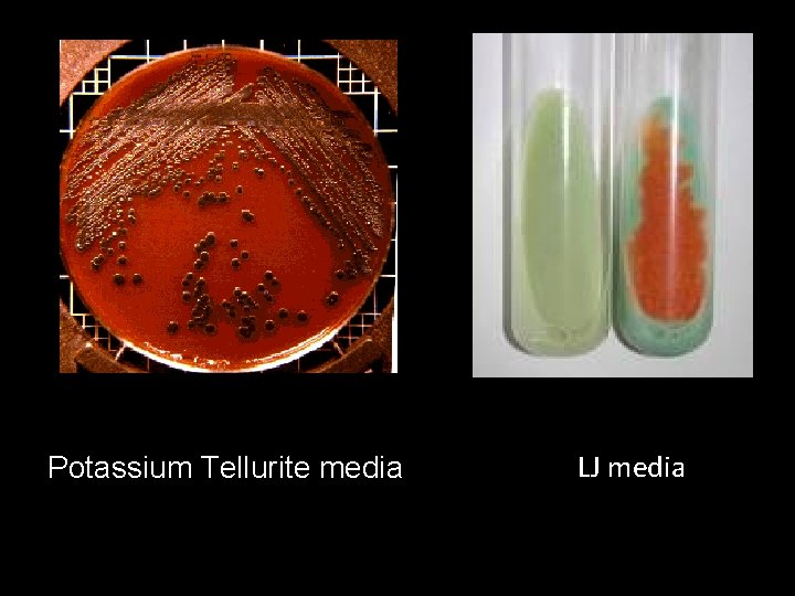 Potassium Tellurite media LJ media 