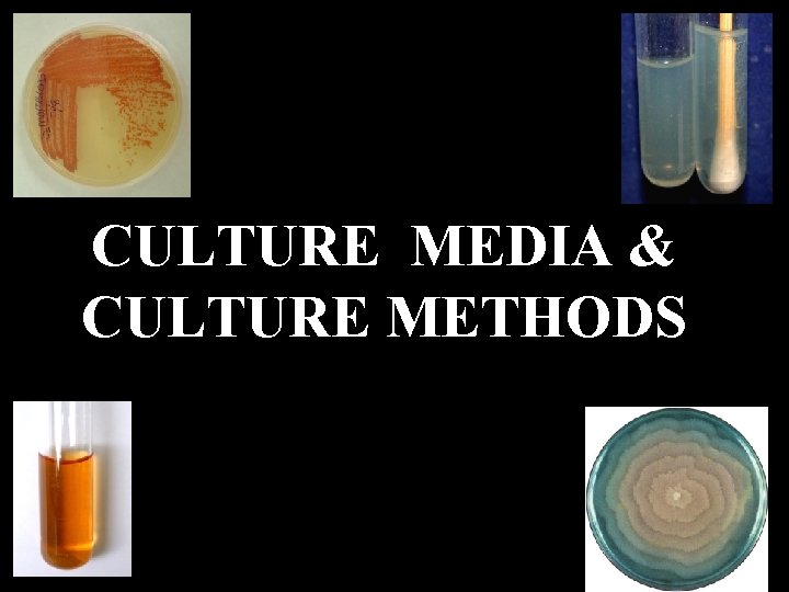 CULTURE MEDIA & CULTURE METHODS 