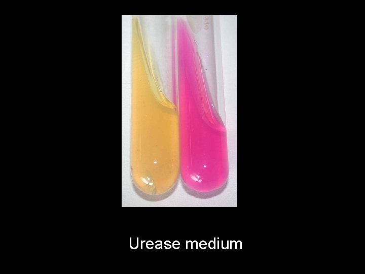 Urease medium 