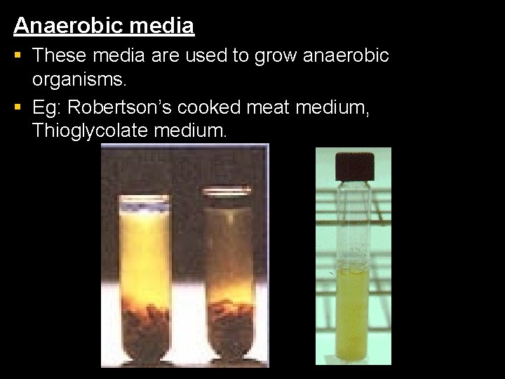 Anaerobic media § These media are used to grow anaerobic organisms. § Eg: Robertson’s