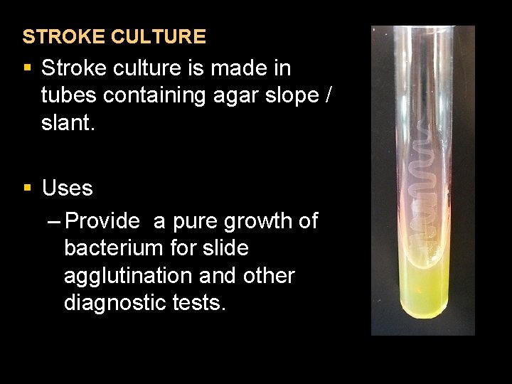 STROKE CULTURE § Stroke culture is made in tubes containing agar slope / slant.