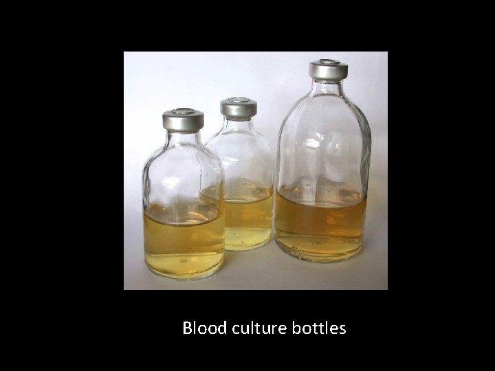 Blood culture bottles 