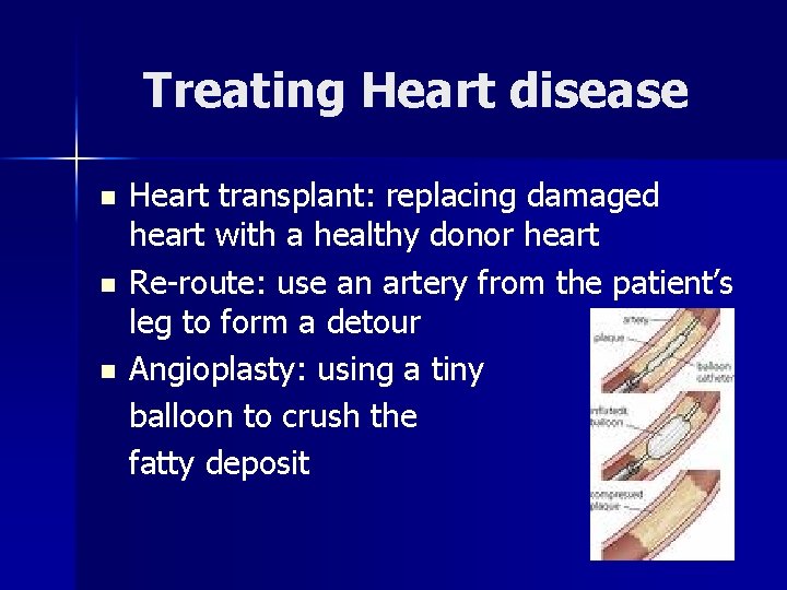 Treating Heart disease n n n Heart transplant: replacing damaged heart with a healthy