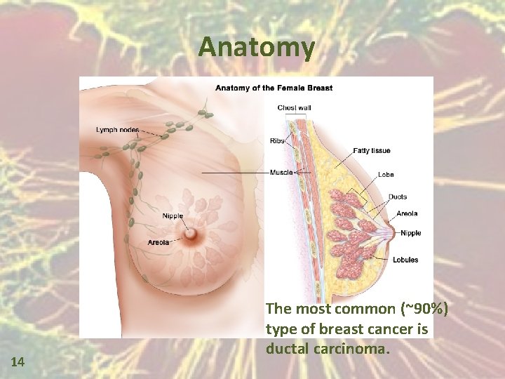 Anatomy 14 The most common (~90%) type of breast cancer is ductal carcinoma. 