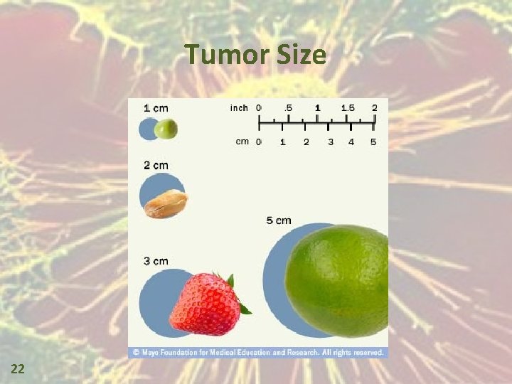 Tumor Size 22 