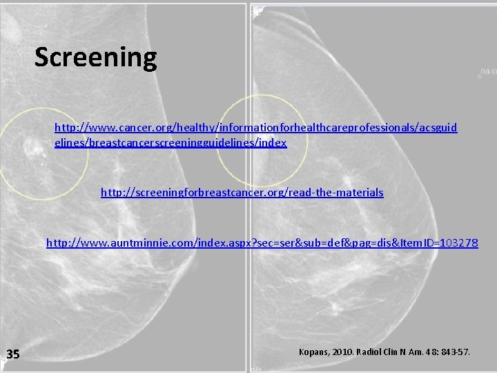 Screening http: //www. cancer. org/healthy/informationforhealthcareprofessionals/acsguid elines/breastcancerscreeningguidelines/index http: //screeningforbreastcancer. org/read-the-materials http: //www. auntminnie. com/index. aspx?