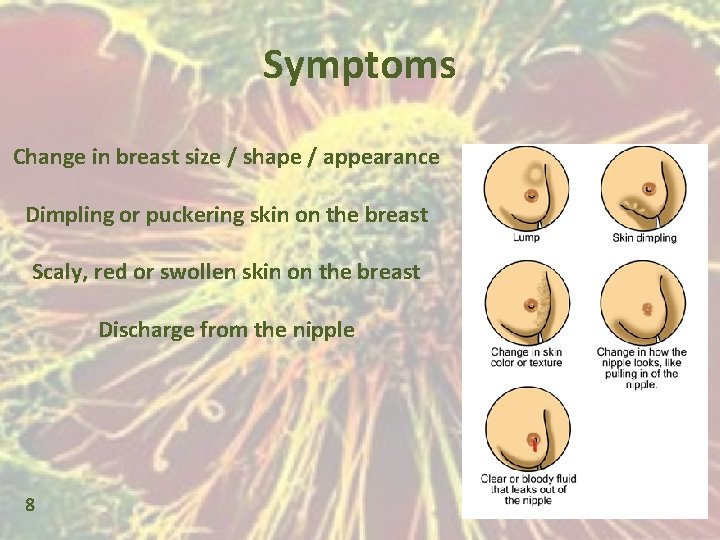 Symptoms Change in breast size / shape / appearance Dimpling or puckering skin on
