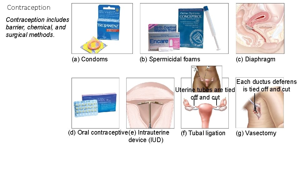 Contraception includes barrier, chemical, and surgical methods. (a) Condoms (b) Spermicidal foams (c) Diaphragm