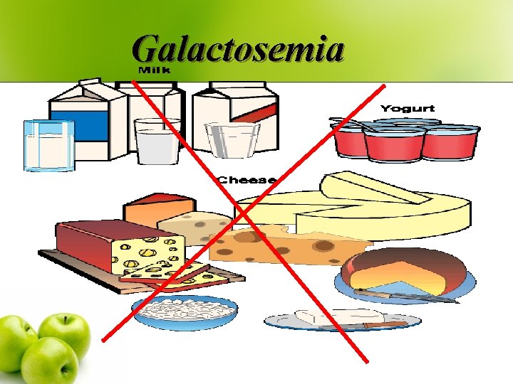 Galactosemia 