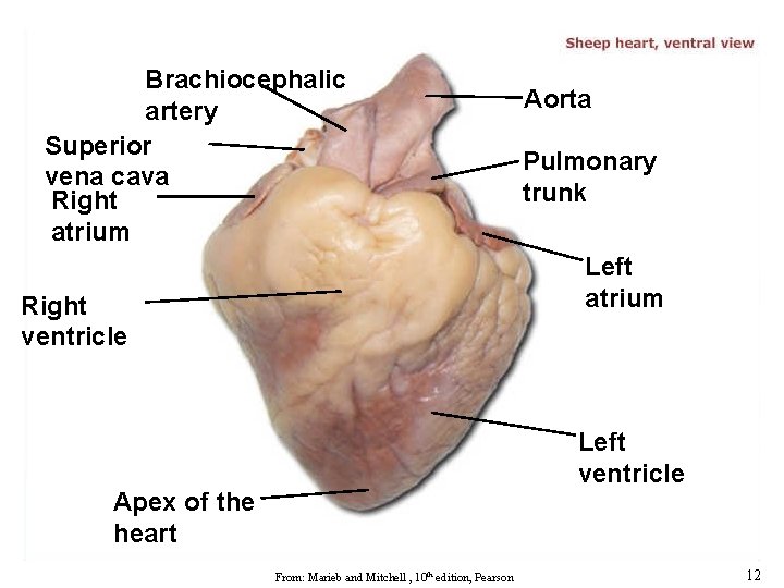 Brachiocephalic artery Superior vena cava Right atrium Aorta Pulmonary trunk Left atrium Right ventricle