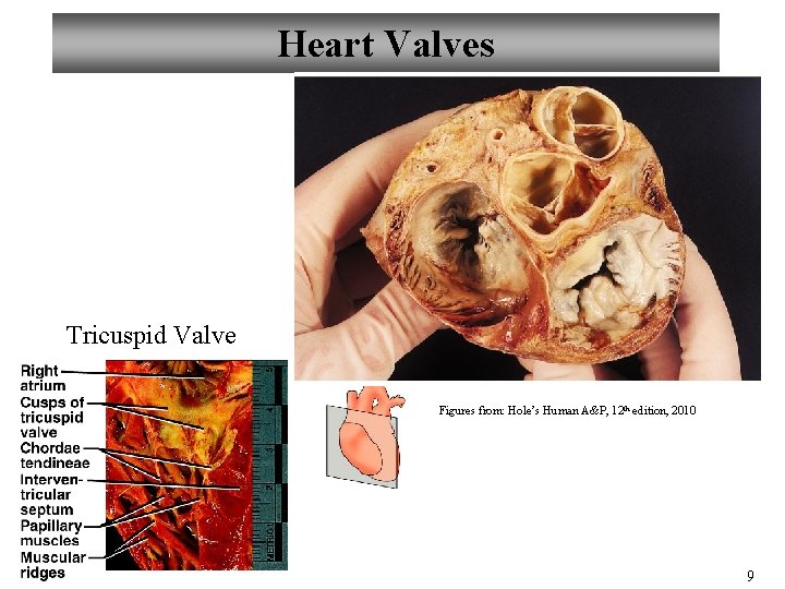 Heart Valves Pulmonary and Aortic Valve Tricuspid Valve Figures from: Hole’s Human A&P, 12