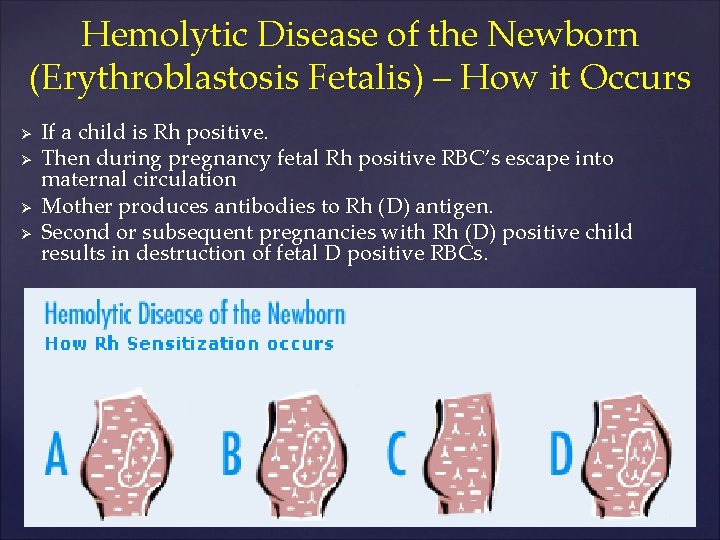 Hemolytic Disease of the Newborn (Erythroblastosis Fetalis) – How it Occurs Ø Ø If
