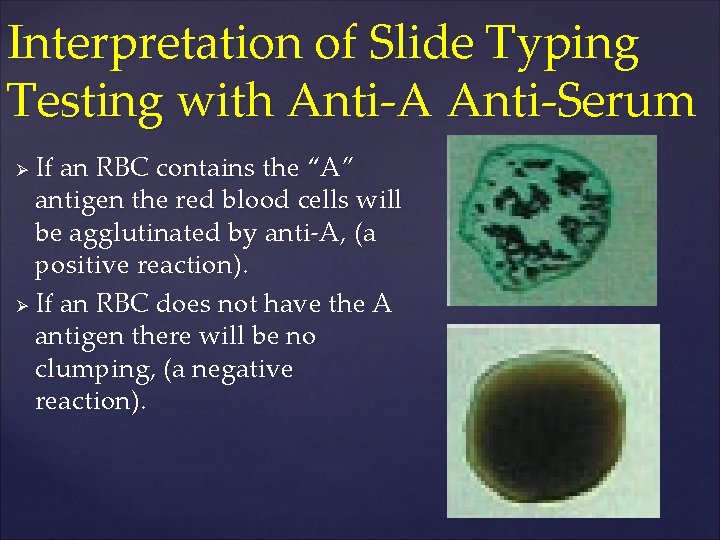 Interpretation of Slide Typing Testing with Anti-A Anti-Serum If an RBC contains the “A”