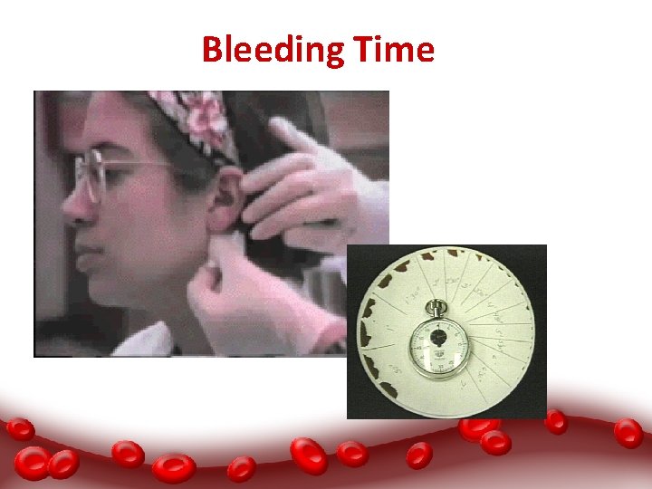 Bleeding Time 