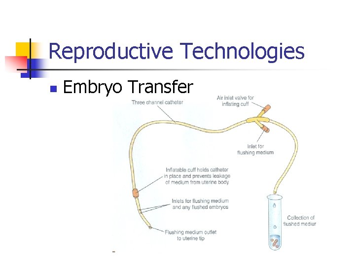 Reproductive Technologies n Embryo Transfer 