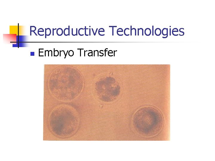Reproductive Technologies n Embryo Transfer 