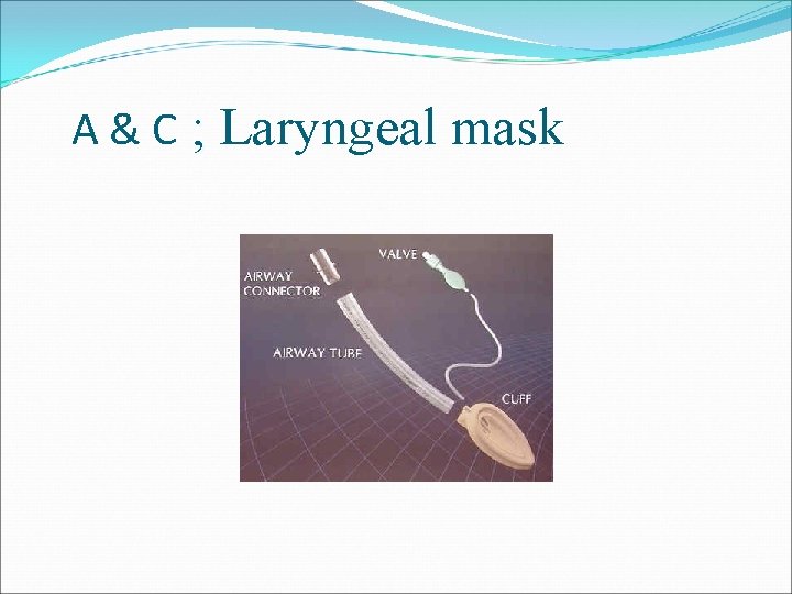 A & C ; Laryngeal mask 