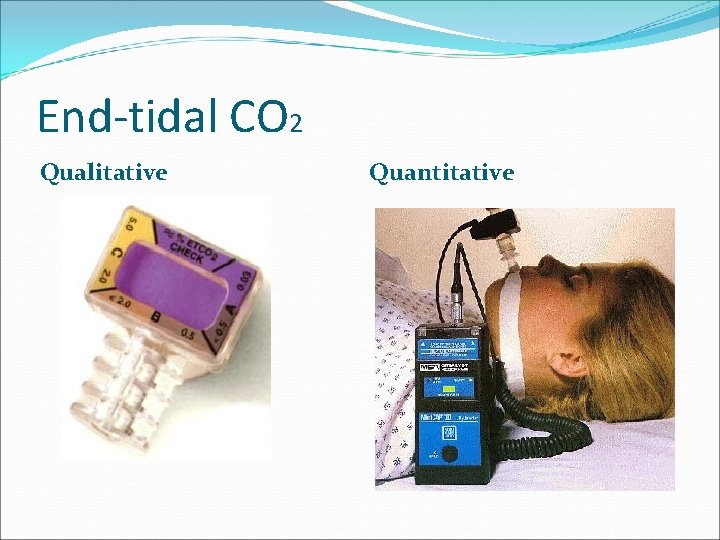 End-tidal CO 2 Qualitative Quantitative 