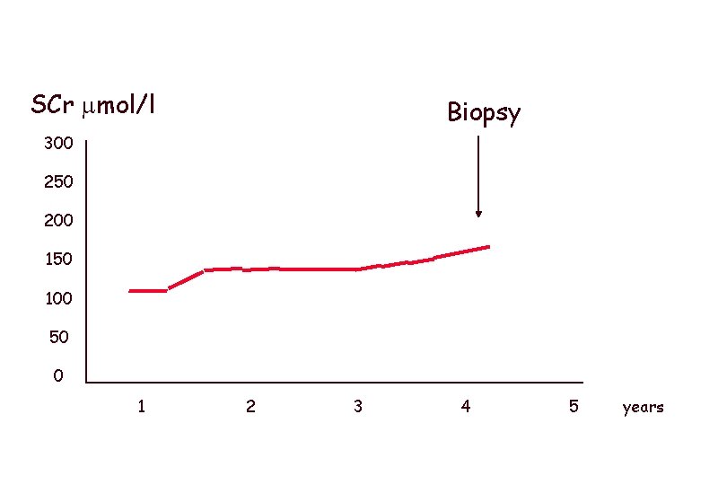 SCr mol/l Biopsy 300 250 200 150 100 50 0 1 2 3 4