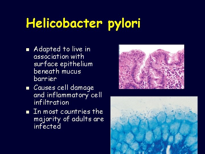 Helicobacter pylori n n n Adapted to live in association with surface epithelium beneath