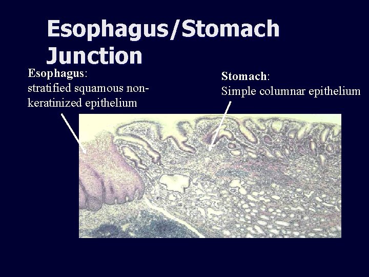 Esophagus/Stomach Junction Esophagus: stratified squamous nonkeratinized epithelium Stomach: Simple columnar epithelium 