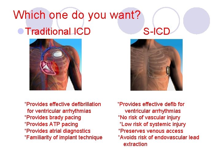 Which one do you want? l Traditional ICD *Provides effective defibrillation for ventricular arrhythmias