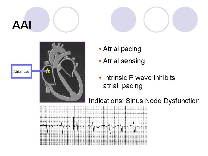 AAI • Atrial pacing • Atrial sensing Atrial lead * • Intrinsic P wave