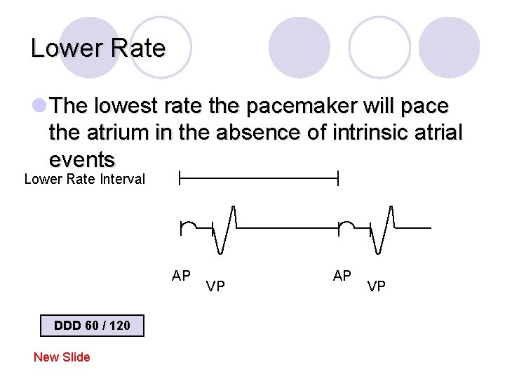 Lower Rate l The lowest rate the pacemaker will pace the atrium in the