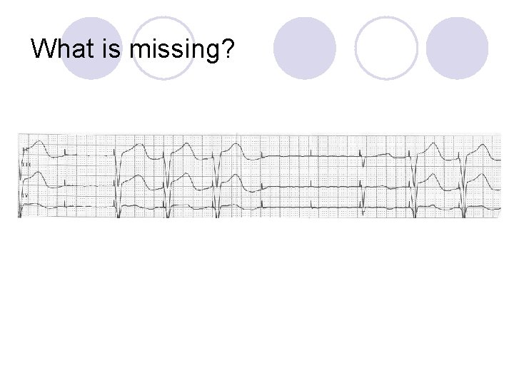 What is missing? 