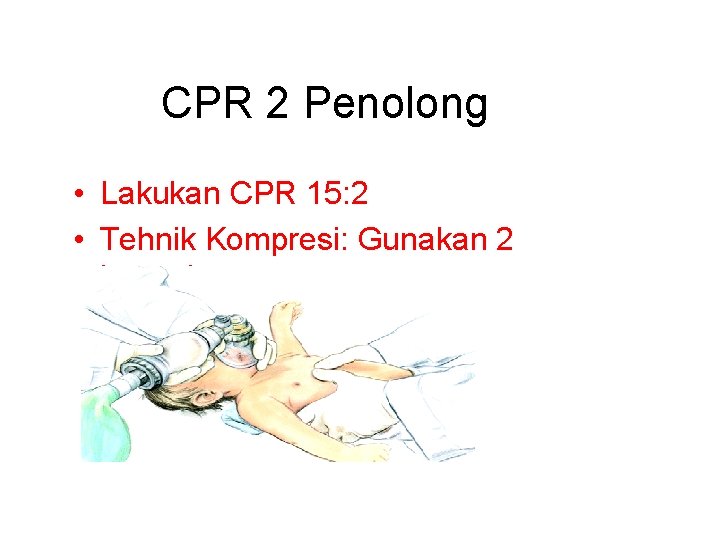 CPR 2 Penolong • Lakukan CPR 15: 2 • Tehnik Kompresi: Gunakan 2 jempol