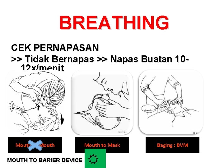 BREATHING CEK PERNAPASAN >> Tidak Bernapas >> Napas Buatan 1012 x/menit Mouth to Mouth