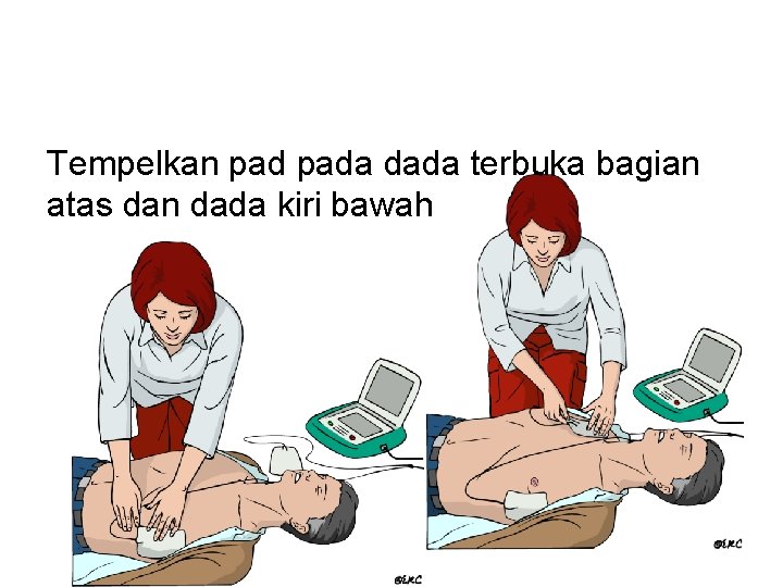 Tempelkan pada dada terbuka bagian atas dan dada kiri bawah 