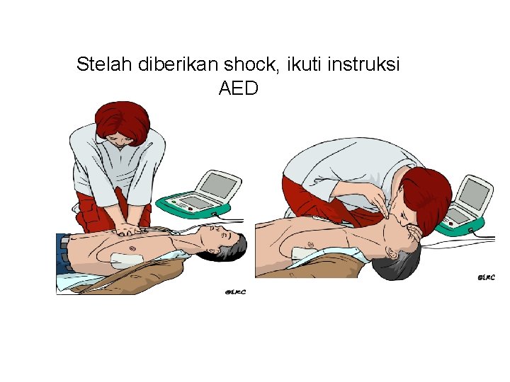 Stelah diberikan shock, ikuti instruksi AED 