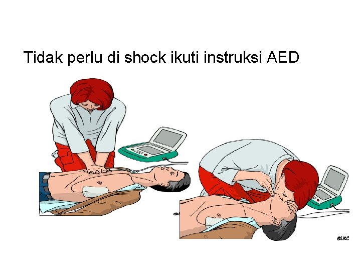 Tidak perlu di shock ikuti instruksi AED 