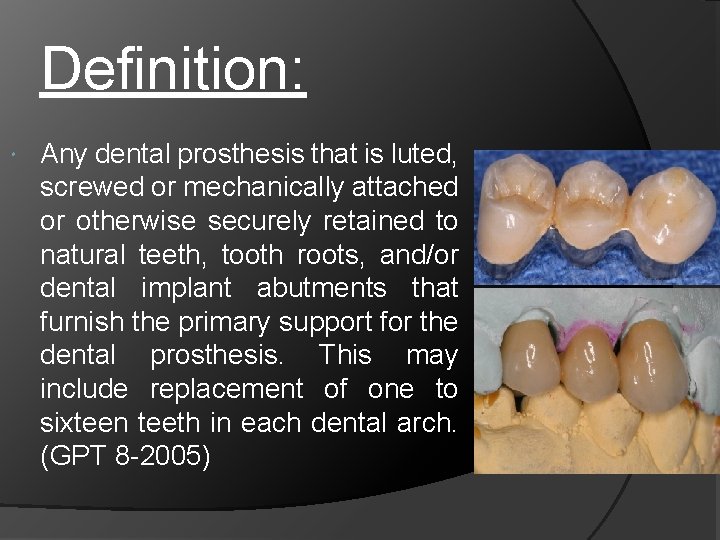 Definition: Any dental prosthesis that is luted, screwed or mechanically attached or otherwise securely