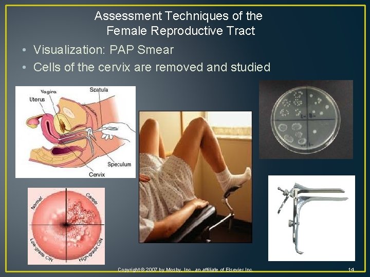 Assessment Techniques of the Female Reproductive Tract • Visualization: PAP Smear • Cells of