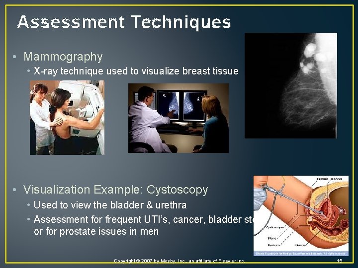Assessment Techniques • Mammography • X-ray technique used to visualize breast tissue • Visualization