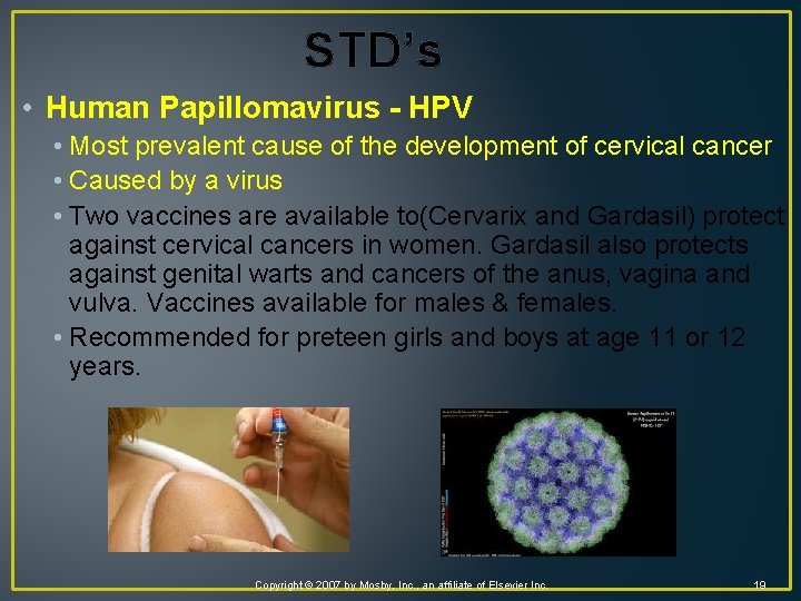 STD’s • Human Papillomavirus - HPV • Most prevalent cause of the development of
