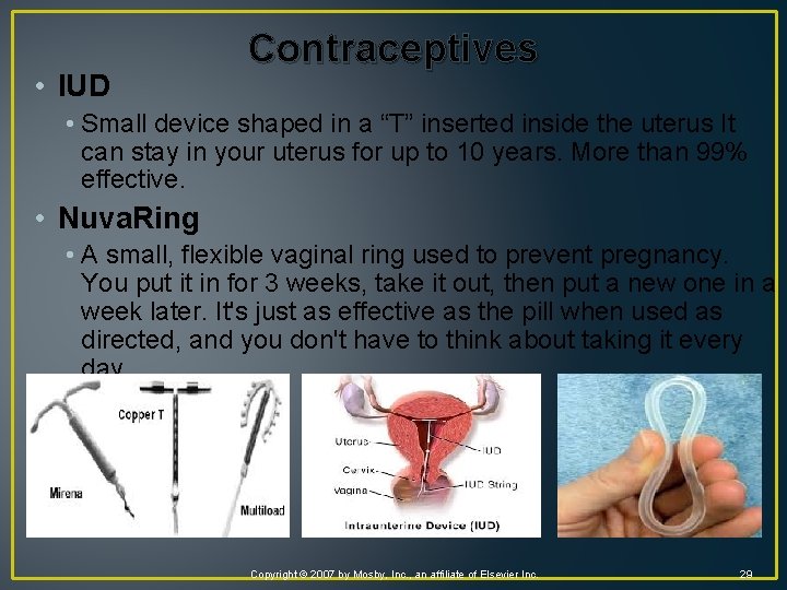  • IUD Contraceptives • Small device shaped in a “T” inserted inside the