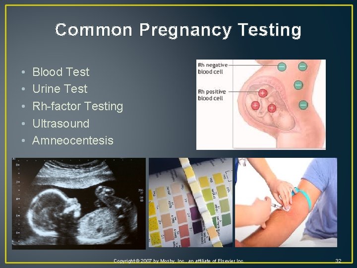 Common Pregnancy Testing • • • Blood Test Urine Test Rh-factor Testing Ultrasound Amneocentesis