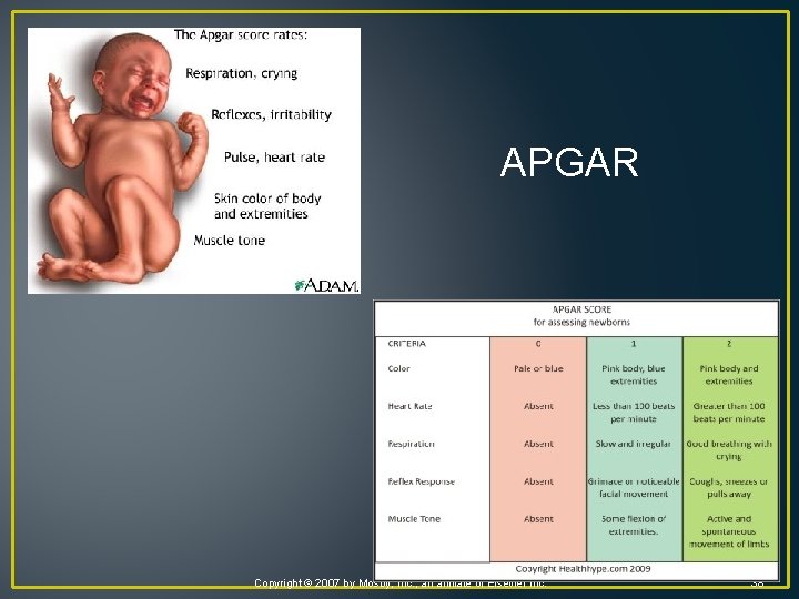 APGAR Copyright © 2007 by Mosby, Inc. , an affiliate of Elsevier Inc. 38