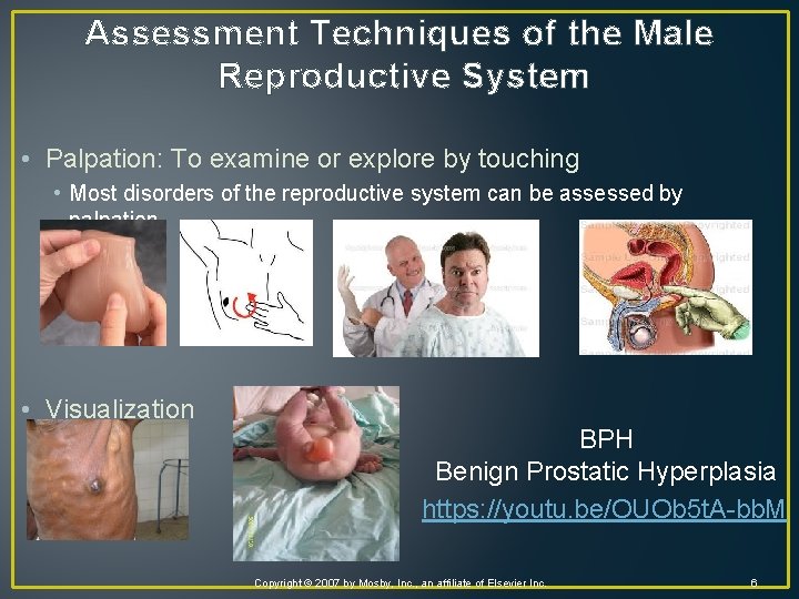 Assessment Techniques of the Male Reproductive System • Palpation: To examine or explore by