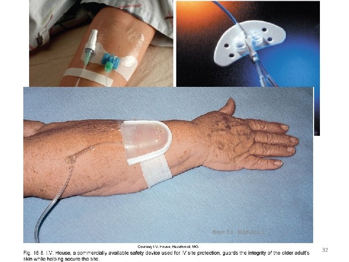 Block 7. 0 Module 1. 1 32 