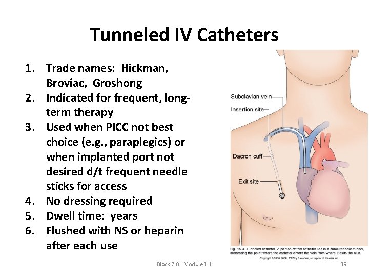 Tunneled IV Catheters 1. Trade names: Hickman, Broviac, Groshong 2. Indicated for frequent, longterm