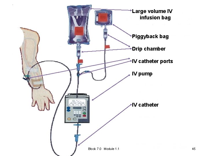 Large volume IV infusion bag Piggyback bag Drip chamber IV catheter ports IV pump