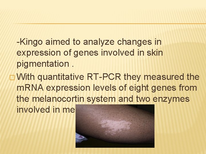 -Kingo aimed to analyze changes in expression of genes involved in skin pigmentation. �