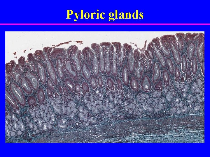 Pyloric glands 