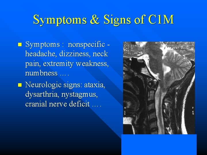 Symptoms & Signs of C 1 M n n Symptoms : nonspecific - headache,